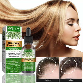 Rosemary Anti-Breakage Nourishing Hair Care Oil - Phosgene