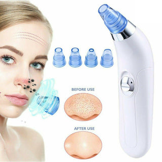 Blackhead Electric Pore Export Blackhead Cleaner - Phosgene