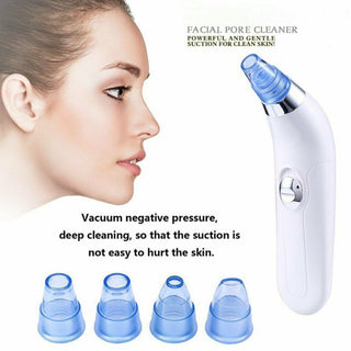 Blackhead Electric Pore Export Blackhead Cleaner - Phosgene