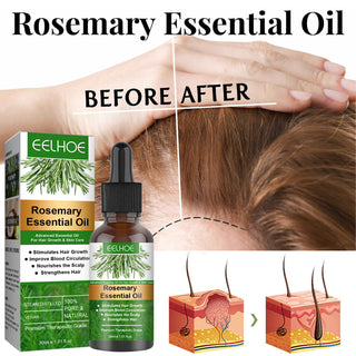 Rosemary Anti-Breakage Nourishing Hair Care Oil - Phosgene