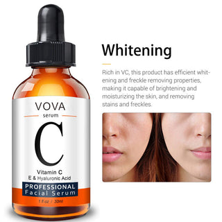 Vitamin C Serum Facial Serum Amazon - Phosgene